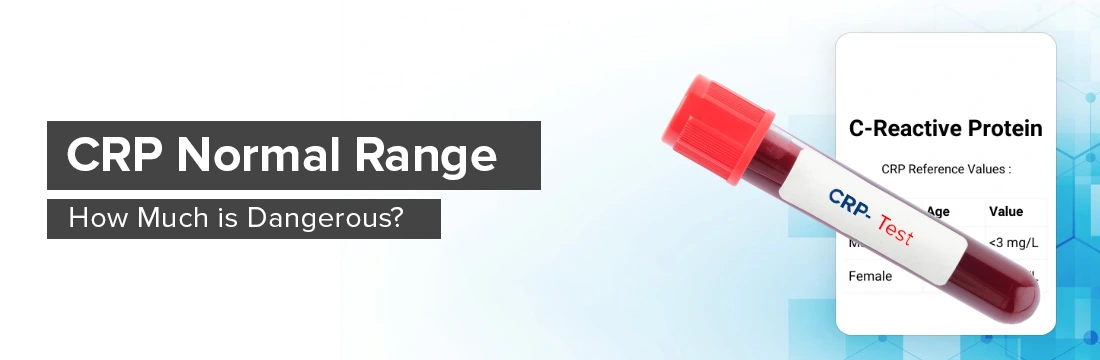  CRP Normal Range: How Much is Dangerous?